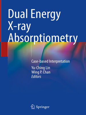 cover image of Dual Energy X-ray Absorptiometry